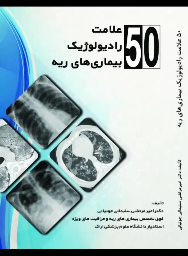 50 علامت رادیولوژیک بیماری های ریه